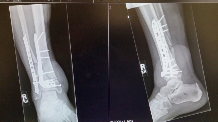 Journey Part 2: Accident to Innovation
